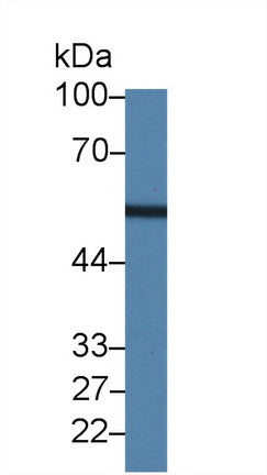 Polyclonal Antibody to Leucine Aminopeptidase (LAP)