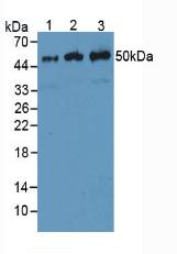 Polyclonal Antibody to Enolase, Neuron Specific (NSE)