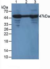 Polyclonal Antibody to Enolase, Neuron Specific (NSE)