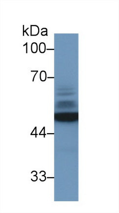 Polyclonal Antibody to Enolase, Neuron Specific (NSE)
