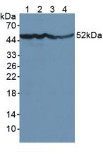 Polyclonal Antibody to Enolase, Neuron Specific (NSE)