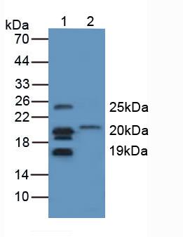 Polyclonal Antibody to Myelin Basic Protein (MBP)