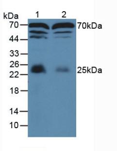 Polyclonal Antibody to Myelin Basic Protein (MBP)