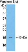 Polyclonal Antibody to Brain Natriuretic Peptide (BNP)