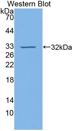 Polyclonal Antibody to Vascular Cell Adhesion Molecule 1 (VCAM1)