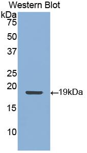 Polyclonal Antibody to Cytokeratin 9 (CK9)