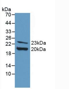 Polyclonal Antibody to Fibroblast Growth Factor 2, Basic (FGF2)