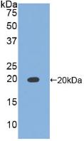 Polyclonal Antibody to Tissue Inhibitors Of Metalloproteinase 1 (TIMP1)