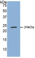 Polyclonal Antibody to Tissue Inhibitors Of Metalloproteinase 1 (TIMP1)