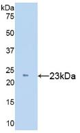 Polyclonal Antibody to Tissue Inhibitors Of Metalloproteinase 1 (TIMP1)