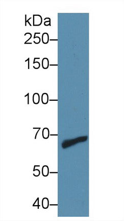 Polyclonal Antibody to Matrix Metalloproteinase 9 (MMP9)