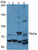 Polyclonal Antibody to Matrix Metalloproteinase 9 (MMP9)