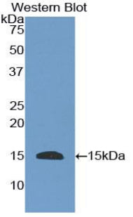 Polyclonal Antibody to Epidermal Growth Factor (EGF)
