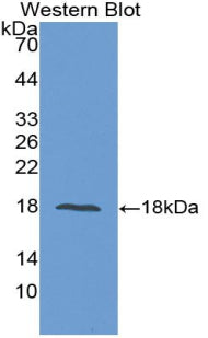 Polyclonal Antibody to Epidermal Growth Factor (EGF)