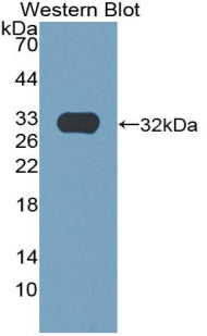 Polyclonal Antibody to Epidermal Growth Factor (EGF)