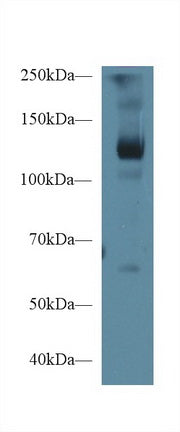 Polyclonal Antibody to Leukemia Inhibitory Factor Receptor (LIFR)