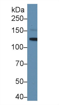 Polyclonal Antibody to Leukemia Inhibitory Factor Receptor (LIFR)