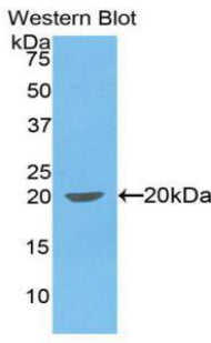 Polyclonal Antibody to Interleukin 1 Beta (IL1b)