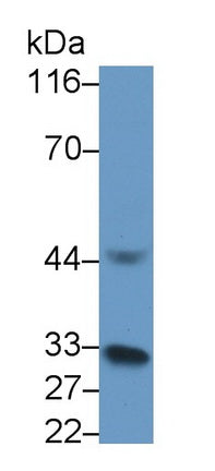 Polyclonal Antibody to Interleukin 1 Beta (IL1b)