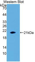 Polyclonal Antibody to Interleukin 1 Beta (IL1b)