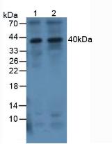 Polyclonal Antibody to Interleukin 1 Beta (IL1b)