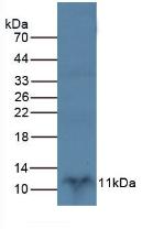 Polyclonal Antibody to S100 Calcium Binding Protein B (S100B)