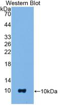 Polyclonal Antibody to S100 Calcium Binding Protein B (S100B)