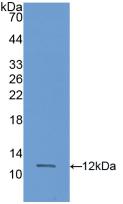 Polyclonal Antibody to S100 Calcium Binding Protein A11 (S100A11)