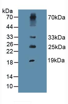 Polyclonal Antibody to Procollagen III N-Terminal Propeptide (PIIINP)