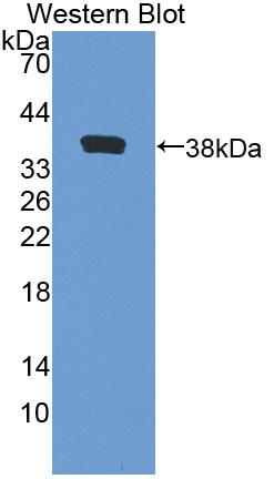 Polyclonal Antibody to Aquaporin 1 (AQP1)