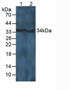 Polyclonal Antibody to Cyclin D1 (CCND1)