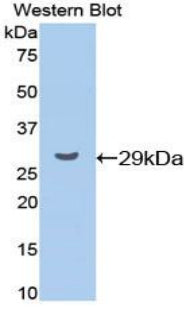 Polyclonal Antibody to Cyclin D1 (CCND1)