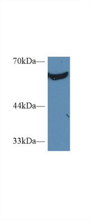 Polyclonal Antibody to Pyruvate kinase isozymes M2 (PKM2)