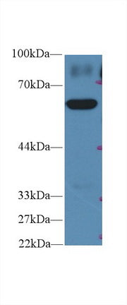 Polyclonal Antibody to Pyruvate kinase isozymes M2 (PKM2)