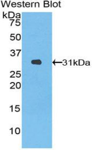 Polyclonal Antibody to Heme Oxygenase 2, Decycling (HO2)