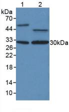 Polyclonal Antibody to Proliferating Cell Nuclear Antigen (PCNA)