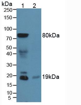 Polyclonal Antibody to Somatostatin (SST)