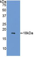 Polyclonal Antibody to Somatostatin (SST)