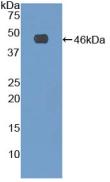 Polyclonal Antibody to Fibrillin 1 (FBN1)