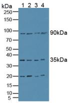 Polyclonal Antibody to Superoxide Dismutase, Copper Chaperone (SOD4)