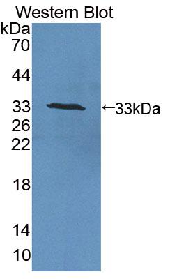 Polyclonal Antibody to Superoxide Dismutase, Copper Chaperone (SOD4)