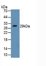 Polyclonal Antibody to Granzyme A (GZMA)