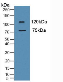 Polyclonal Antibody to Myeloperoxidase (MPO)