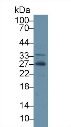 Polyclonal Antibody to Adiponectin (ADPN)