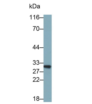 Polyclonal Antibody to Adiponectin (ADPN)