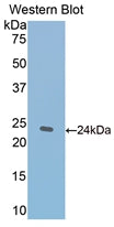 Polyclonal Antibody to Thrombospondin 1 (THBS1)