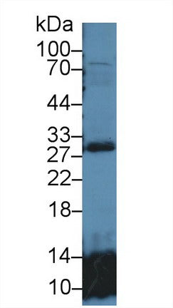 Polyclonal Antibody to Glutathione S Transferase Theta 2 (GSTt2)