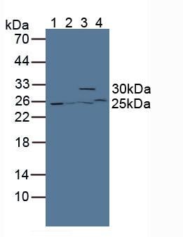 Polyclonal Antibody to Glutathione S Transferase Theta 2 (GSTt2)