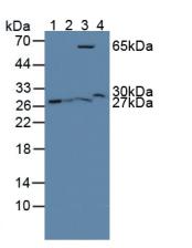 Polyclonal Antibody to Glutathione S Transferase Theta 2 (GSTt2)