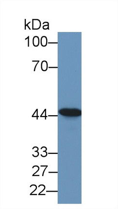 Polyclonal Antibody to Tachykinin Receptor 2 (TACR2)